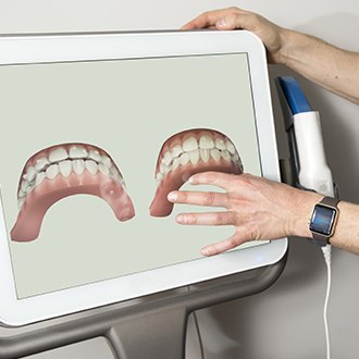 Digital impressions on chairside computer