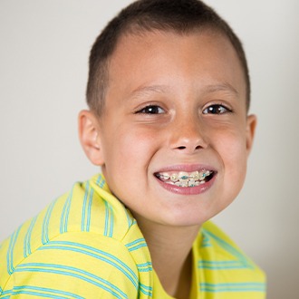 Young boy with pediatric orthodontics smiling