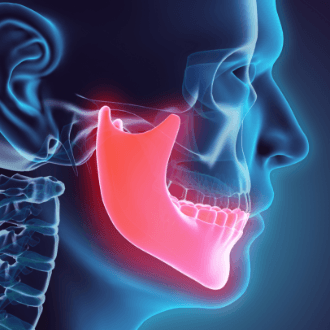 Animated jaw and skull bone used for dentofacial orthopedics treatment planning