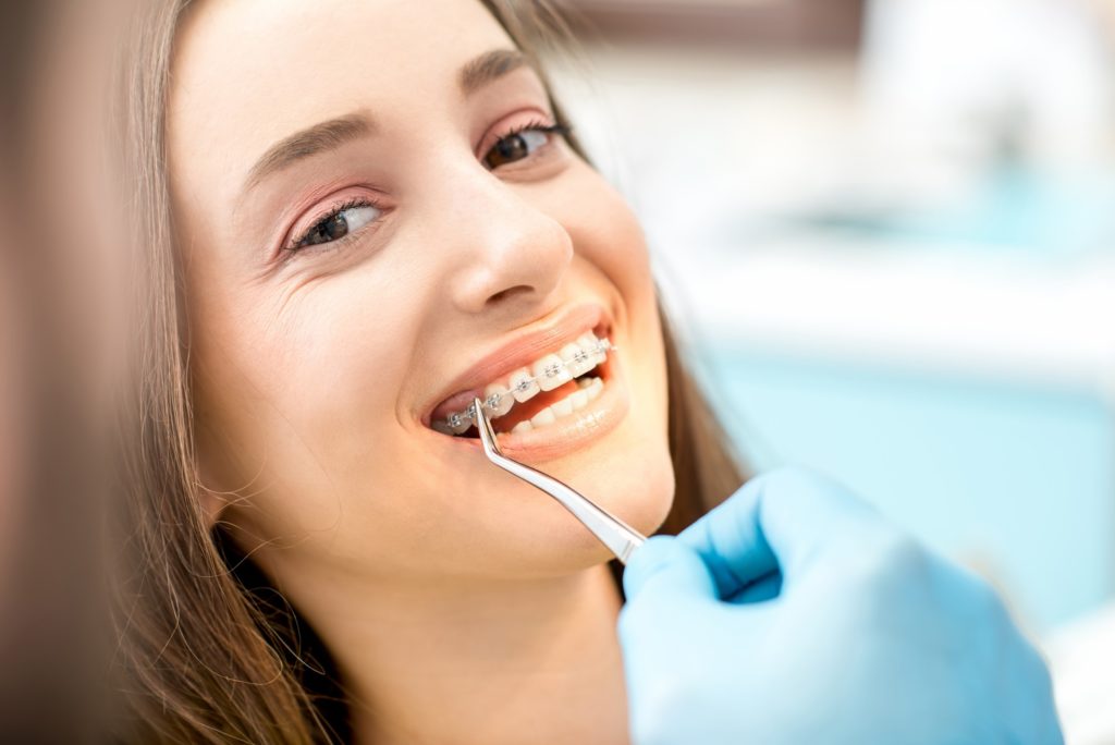 Closeup of woman at braces removal appointment